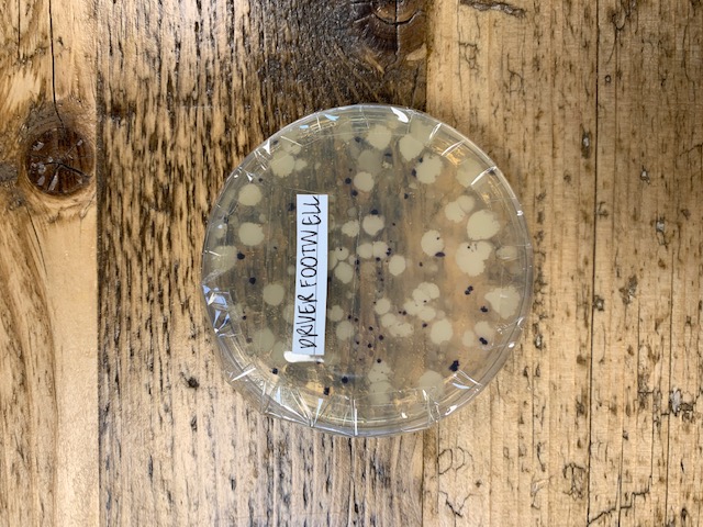 Day 5 Driver Footwell Germs